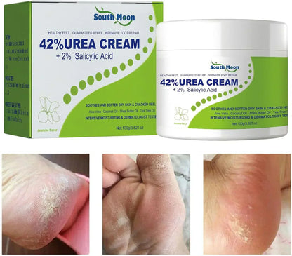 South Moon 42% Urea and 2% Salicylic Acid cream in a jar, skincare product for dry and rough skin care