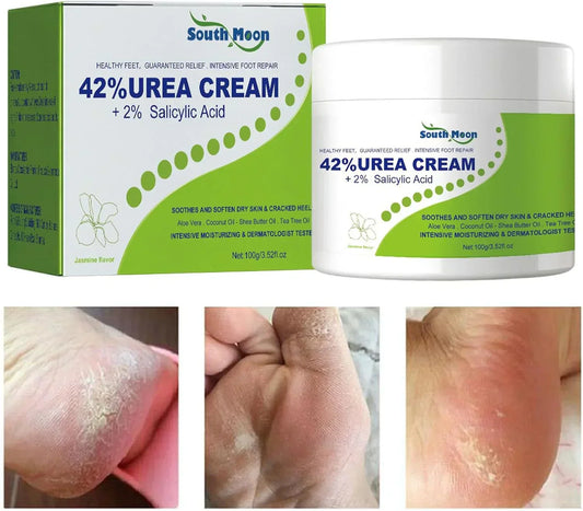 South Moon 42% Urea and 2% Salicylic Acid cream in a jar, skincare product for dry and rough skin care