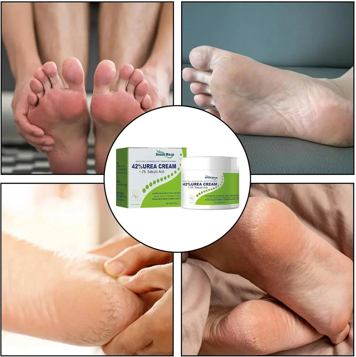 South Moon Urea Cream with 2% Salicylic Acid, moisturizing skincare product in a white jar with blue label.