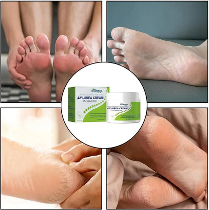 South Moon Urea Cream with 2% Salicylic Acid, moisturizing skincare product in a white jar with blue label.