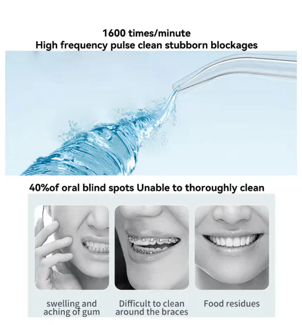 Iqbal's Cart Oral Irrigator for dental cleaning and oral health, featuring a sleek design and ergonomic handle.