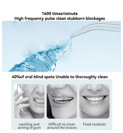 Iqbal's Cart Oral Irrigator for dental cleaning and oral health, featuring a sleek design and ergonomic handle.